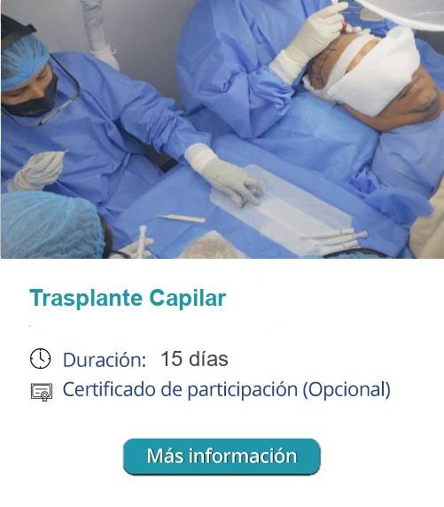 transplanteCapilar